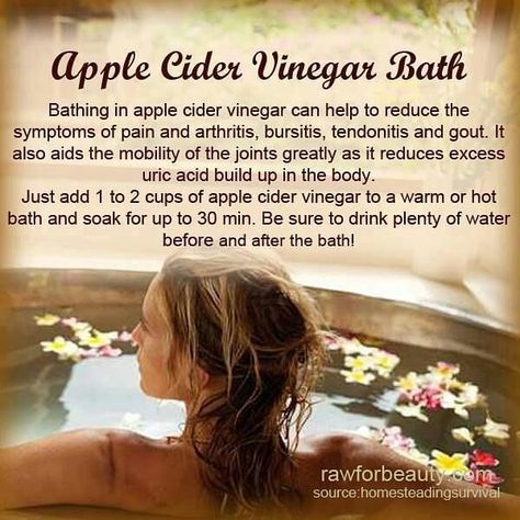 Blue miracle 1 Vinegar Bath, Apple Cider Vinegar Bath, Apple Cider Vinegar Remedies, Organic Apple Cider, Organic Apple Cider Vinegar, Uric Acid, Joints Pain Relief, Cider Vinegar, Health Remedies