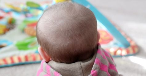 Many babies lose their hair during their first six months due to hormone fluctuations. This is not preventable, and new hair eventually grows. A bald spot on the back of a baby's head not related to hormones. In rare instances such bald spots indicate a fungal infection; however, they typically result from the baby spending too much time lying on... Exercise And Mental Health, Bald Patches, Bald Spot, Bald Hair, Fungal Infection, Lost Hair, Baby Center, Health Department, Baby Development