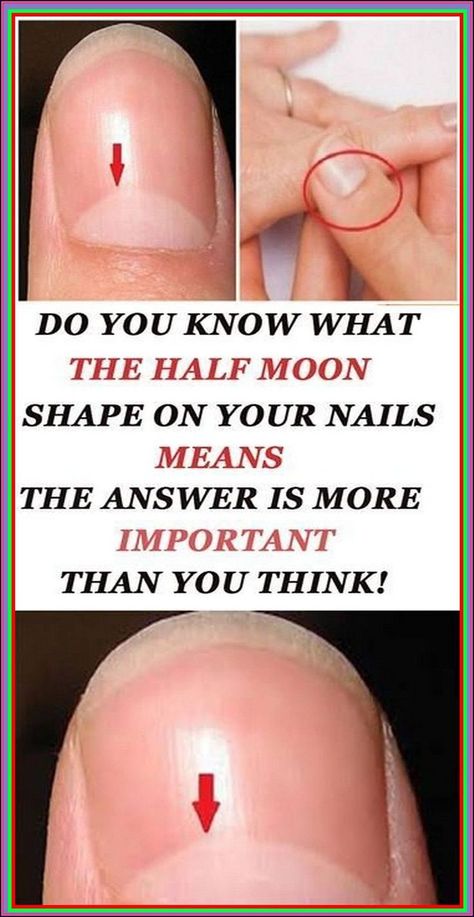 DO YOU KNOW WHAT THE HALF MOON SHAPE ON YOUR NAILS MEANS THE ANSWER IS IMPORTANT! Moon On Nails, Body Facts, Healthy Hacks, Layers Of The Epidermis, Half Moons, Health Topics, Awesome Photography, Urban Survival, Pallet Garden