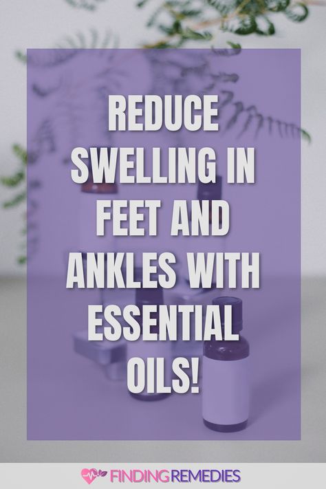 Reduce Swelling in Feet and Ankles with Essential Oils! Feet Swelling Remedies, Natural Diuretic For Swelling, Essential Oil For Swelling, Swelling Remedies, Calcium Channel Blockers, Top Essential Oils, Swollen Ankles, Cypress Oil, Be Uncomfortable