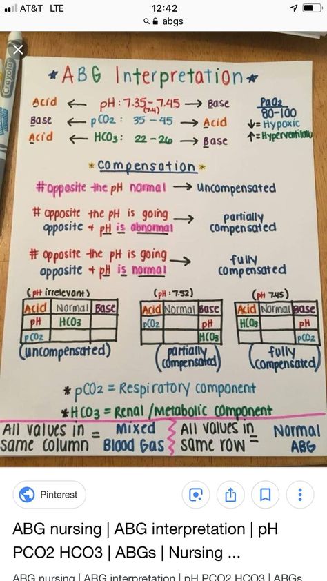 Nursing Desmopressin Nursing, Pre Op Nursing Checklist, Hypervolemia Nursing, Advanced Med Surg Nursing, Nursing Students Humor, Nursing School Notes Study Guides, Registered Nurse School, Nursing School Life, Paramedic School