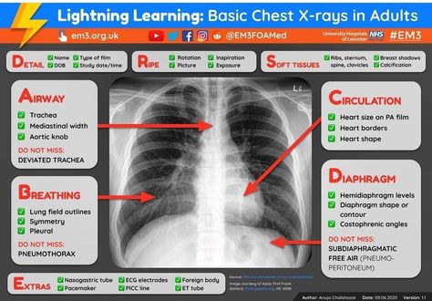 Radiology Notes, Radiology Anatomy, Diagnostic Medical Sonography Student, Medical Radiography, Hospital Medicine, Sonography Student, Radiology Student, Medical Ultrasound, Diagnostic Medical Sonography