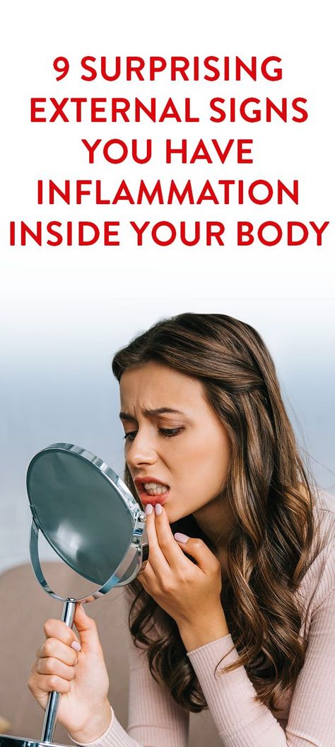 9 Surprising External Signs You Have Inflammation Inside Your Body Skin Inflammation Remedies, Inflammation Remedies, Signs Of Inflammation, Body Inflammation, Nerve Pain Relief, Anti Inflammation, Body Balance, Meal Recipes, Yoga Fashion