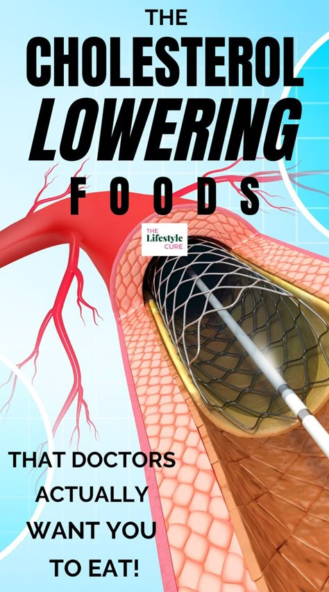 As a doctor, high cholesterol is seen as a common occurrence in medicine. However what's not discussed enough is how a cholesterol diet and cholesterol lowering foods can help. We dive deep into what types of foods can help lower your bad cholesterol and total cholesterol too. Causes Of High Cholesterol, Food Lower Cholesterol, Foods That Cause High Cholesterol, Lower Bad Cholesterol Diet, Low Carb And Cholesterol Recipes, How To Lower Your Cholesterol, Food For High Cholesterol, High Cholesterol Remedies, Cholesterol Meal Plan