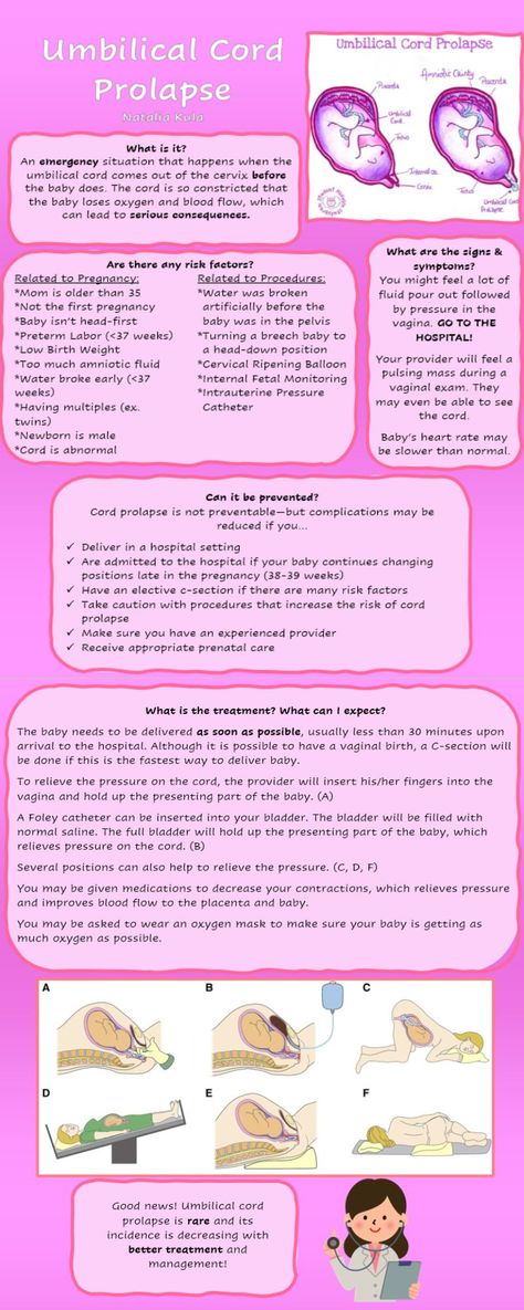 Nicu Nursing Education, Cord Prolapse, Labour And Delivery Nurse, Ped Nurse, Fetal Heart Monitoring, Nursing School Inspiration, Midwifery Student, Medical Life, Nurse Study