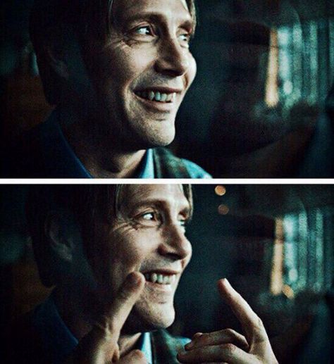 Mason Verger Hannibal, Mason Verger, Tripping Balls, Hannibal Suit, Camera Crew, Hannibal Funny, Will Graham Hannibal, Hannibal Tv Series, Happy One Year Anniversary