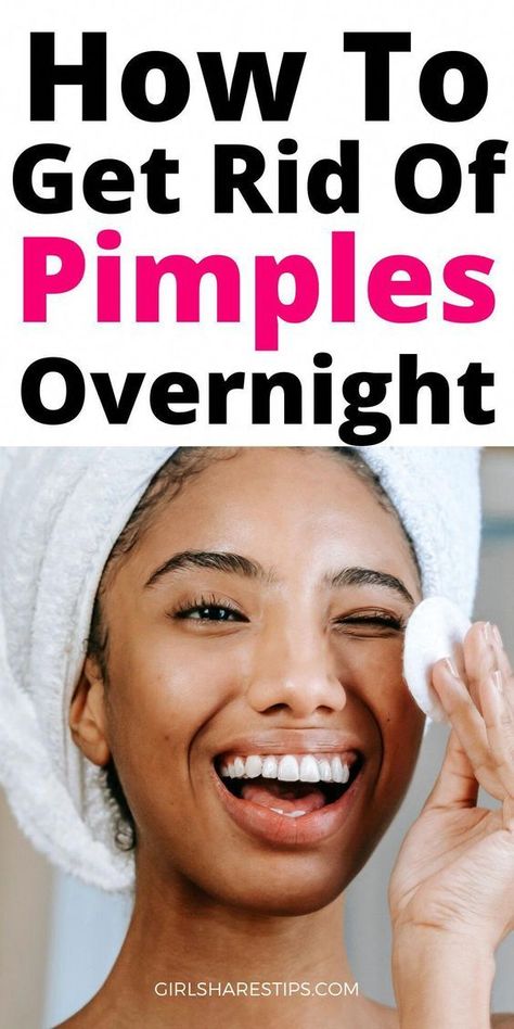 How To Get Rid Of Pimples Overnight - Girl Shares Tips #acne #pimples #pimplesremedies #acneremedies #skincarediy. https://whispers-in-the-wind.com/combatting-pimples-under-the-skin-expert-tips-and-product-recommendations/?32 How To Clear Spots On Face, How To Clear Acne Overnight, How To Get Clear Skin Naturally At Home, How To Get Clear Skin In A Week, How To Get Clear Skin Overnight, How To Get Rid Of Pimples Overnight, Clear Acne Overnight, Get Rid Of Pimples Overnight, Rid Of Pimples Overnight