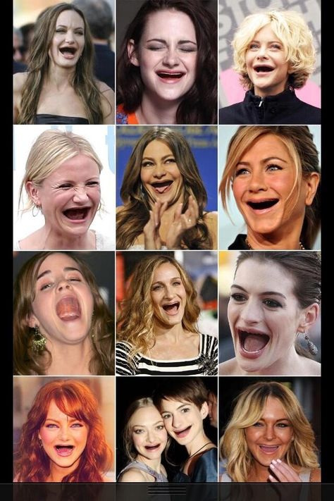 celebrities with no teeth! Dental Fun, Best Teeth Whitening, Dental Humor, Popular Actresses, Makijaż Smokey Eye, Funny Fails, Oral Health, Bones Funny, Make Me Smile