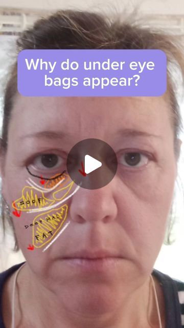 Takeclass Shine on Instagram: "Under eye bags bothering you?   Do this complex!   Full technique and even more exercises can be found on my course “Mindful Face Fitness”  Click the link in bio to join ❗️" Under Eye Bag Exercises, How To Treat Under Eye Bags, How To Get Attractive Eyes, How To Remove Eye Bags, Cover Under Eye Bags, Baggy Eyes Remedy, Bags Under Eyes Remedy, Eye Bags Remedy, Under Eyes Bags