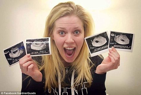 Quadruplets: Mrs Gardner, who suffers from endometriosis - a condition where cells from the lining of the womb grow in other areas of the body - is pictured holding up scans of her four babies, who are all girls Gardner Quad Squad, Quad Squad, First Ultrasound, Thanks God, After Eight, Mother Love, Baby D, Trying To Get Pregnant, German Women