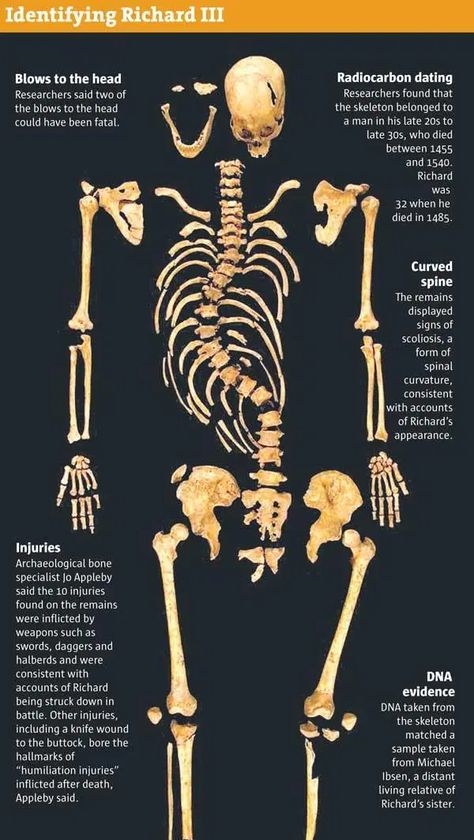 King Richard Iii, King Richard 111, Medieval Britain, Royal Family History, Anne Neville, Historical Nonfiction, S King, People Reference, Alfred The Great