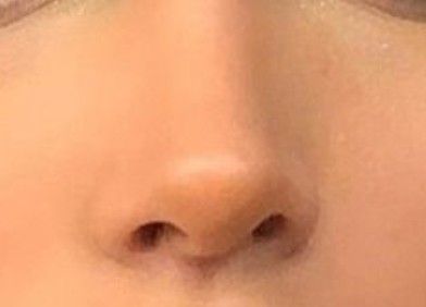 Upturned Nose, Rhinoplasty Nose Jobs, Straight Nose, Pretty Nose, Nose Makeup, Perfect Nose, Small Nose, Button Nose, Nose Shapes