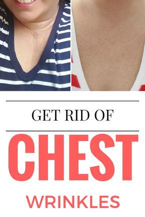 How to Get Rid of Chest Wrinkles (Décolleté) FAST--from sleeping on your side Diy Wrinkle Cream, Treating Cystic Acne, Chest Wrinkles, Chest Acne, Wrinkle Remedies, Neck Firming, Wrinkle Filler, Skin Care Routine For 20s, Dry Skin Patches