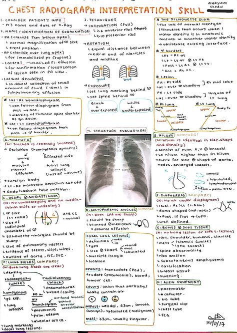 Chest X Ray Radiology, X Ray Technique Chart, Chest X Ray Interpretation, X Ray Positioning Chart, World Radiology Day Poster, X Ray School, Chest Xray Interpretation, Radiology Notes Aesthetic, Radiology Technician Student