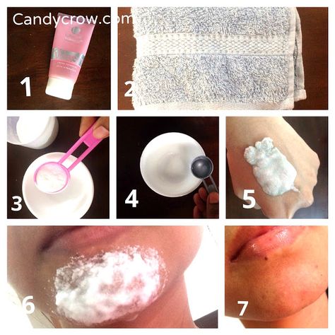 How to get rid of whiteheads at home in 5 minutes? Remove Whiteheads, Baking Soda For Acne, Baking Soda Face Scrub, Baking Soda Scrub, Baking Soda Face Mask, Face Scrubs, Baking Soda Face, Homemade Moisturizer, Diy Acne