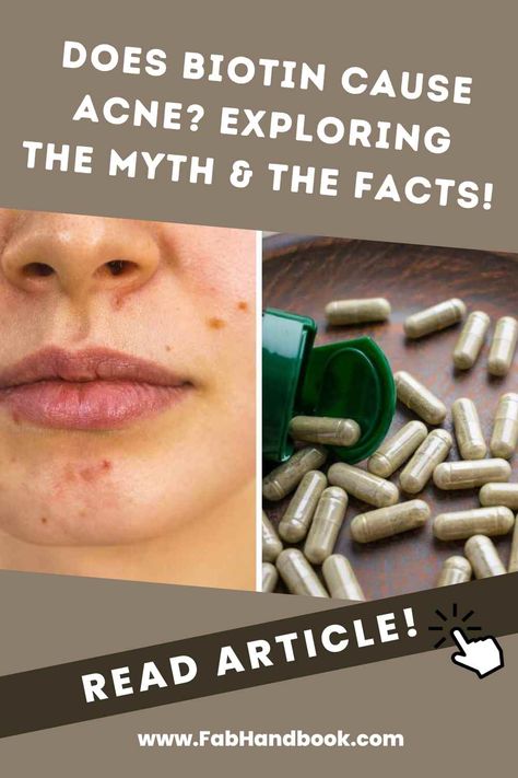 Is Biotin a miracle vitamin or the enemy of your acne prone skin? Find out with our insider guide to busting the biotin breakout myth. Biotin Results, Biotin Benefits, Biotin Supplement, Cystic Acne, Face Acne, Food Facts, A Miracle, Acne Prone Skin, Skin Care Tips