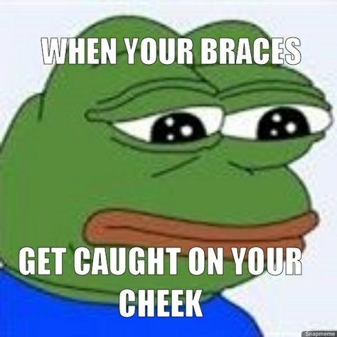 #growingupwithbraces #Memes #SlothQueen04 #Pepe Brace Teeth Meme, Braces Memes Humor, Braces Memes Funny, Braces Jokes, Braces Meme, Braces Funny, Braces Problems, Braces Humor, Dental Braces Colors