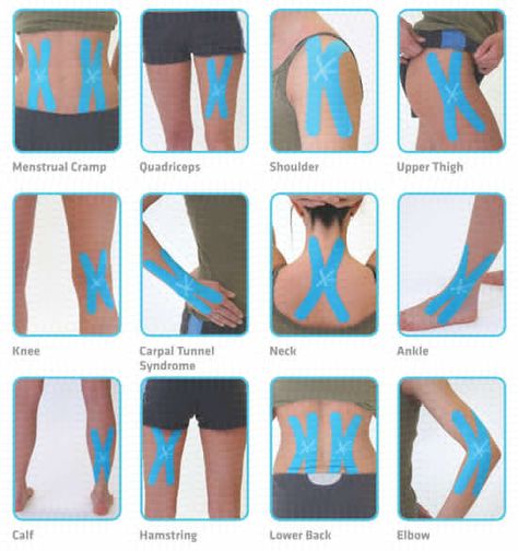 Kinesio Taping, Elbow Pain, Sports Tape, Kinesiology Taping, Nerve Pain Relief, Knee Pain Relief, Athletic Training, Medical Knowledge, Trening Abs