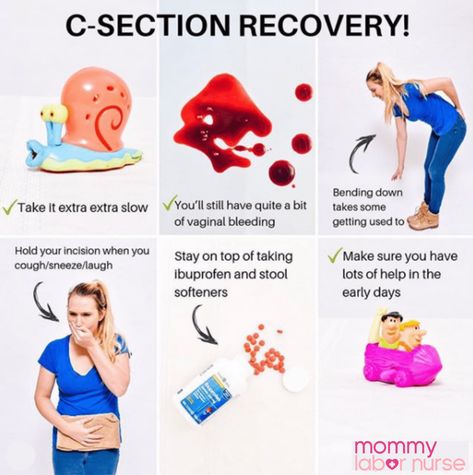 C Section Recovery: What Happens Right After Your C Section Postpartum Symptoms, Scheduled C Section, Hospital Bag List, Postpartum Care Kit, Pregnancy Facts, C Section Recovery, Baby Delivery, Labor Nurse, Newborn Mom