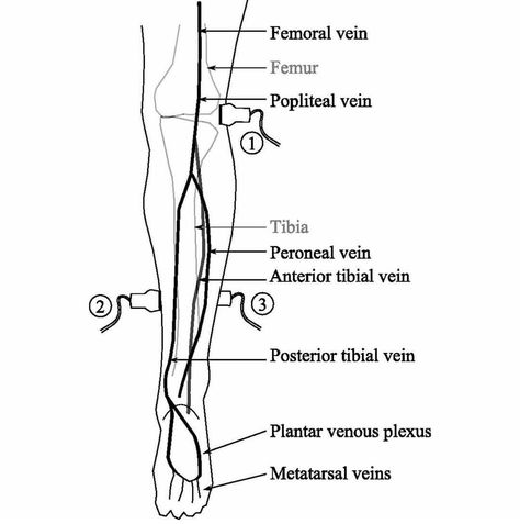 Vascular Sonography, Diagnostic Medical Sonography Student, Ultrasound School, Arteries Anatomy, Cardiac Sonography, Doppler Ultrasound, Vascular Ultrasound, Sonography Student, Ultrasound Sonography