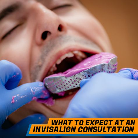 What ACTUALLY happens at an #orthodontic consultation for #Invisalign? How long a does #consultation usually take? Will there be anything #unpleasant or #uncomfortable? Diy Braces, Adult Braces, Dental Impressions, Dental Restoration, Chemical Structure, General Dentistry, Dental Procedures, Dental Lab, Dental Practice