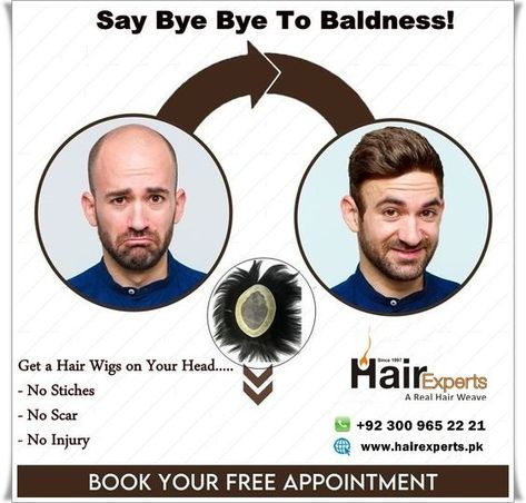 Wigs For Men, Hair Wigs For Men, Bald Patches, Natural Looking Wigs, Hair Fixing, Photoshop Tutorial Design, Say Bye, Hair Replacement, Hair Transplant