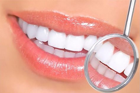 Coconut Oil Teeth Whitening, Tooth Gel, Teeth Whitening Remedies, Teeth Whitening Diy, Teeth Whitening Toothpaste, Porcelain Veneers, Perfect Teeth, Teeth Whitening Pen, Teeth Health