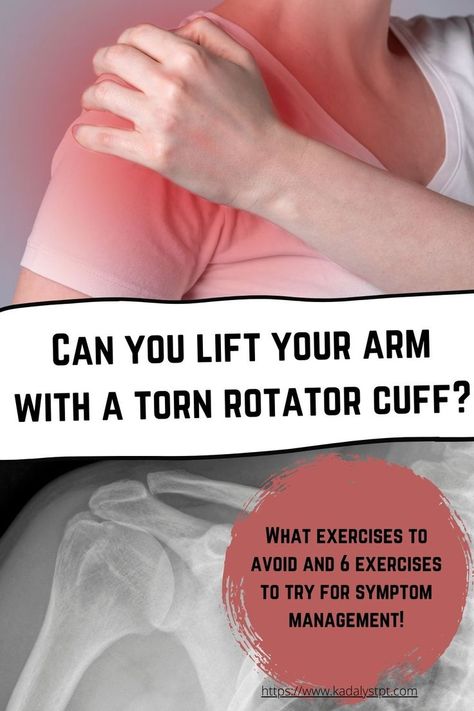 Torn Rotator Cuff Exercises, Torn Rotator Cuff Symptoms, Rotator Cuff Injury Exercises, Rotator Cuff Stretches, Torn Rotator Cuff, Rotator Cuff Pain, Rotator Cuff Exercises, Muscle Tear, Rotator Cuff Tear