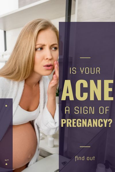 Do you have a weird breakout that seems un-explainable? Acne can actually be one of the first symptoms, even before your missed period.  Here's why and how to know, because not all women will get acne during pregnancy.    #pregnancyacne #acneduringpregnancy #pregnancy #skincare #natural #acne #signofpregnancy Sign Of Pregnancy, Pimple Causes, Pregnancy Acne, Missed Period, Blind Pimple, Pimples Under The Skin, Skincare Habits, Early Pregnancy Signs, Bad Acne