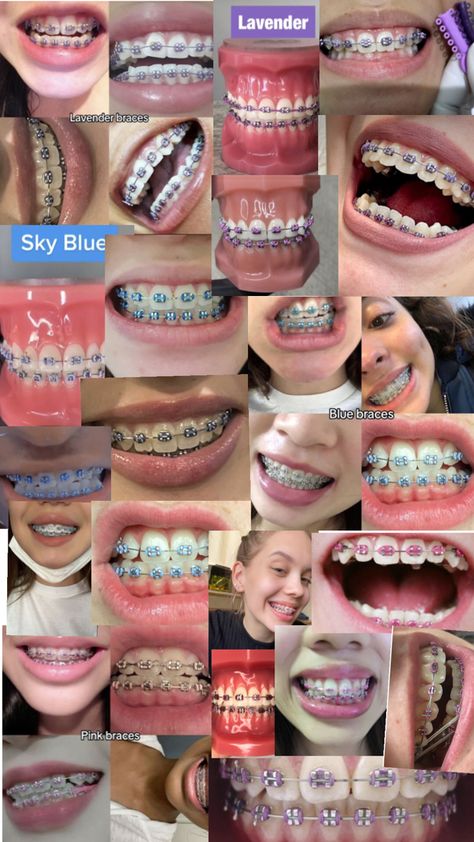 Blue 💙 Purple 💜 and Pink 💖 Perfect Teeth Braces, Celebrities With Braces, Light Blue Braces, Dental Braces Colors, Braces Colors Combinations, Pink Braces, Cute Braces Colors, Pretty Teeth, Braces Tips