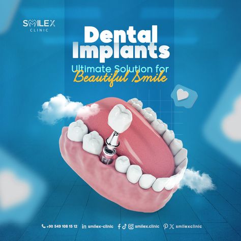 😊Say goodbye to gaps and hello to a beautiful smile with dental implants .  💪the ultimate solution for restoring your confidence!  💪 At SmileX, our experienced team ensures seamless integration and natural-looking results.  📞Reclaim your smile and schedule your implant consultation today!  ⚪ISTANBUL TÜRKÌYE  #orthodontics #straightteeth #veneers⁠ #tooth #dentalimplants #teethwhitening ⁠ #dentist #dental #dentistry #teeth⁠ #İstanbul #türkiye ⁠ Dental Implants Creative Ads, Dental Post, Burger Ads, Dental Ads, Cosmetic Web, Dental Advertising, Dental Social Media, Dental Posts, Dental Logo Design