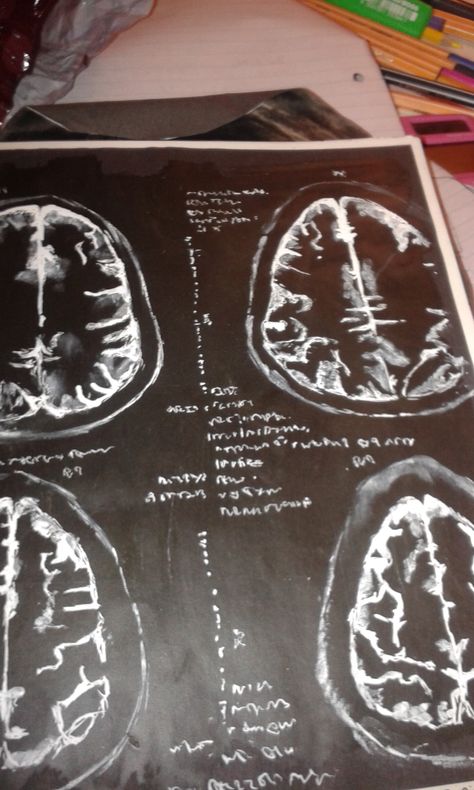 brain scans Brain Scan Neuroscience, Brain Scan Aesthetic, Brain Tumour Fake Report, Ct Scan Brain, Brain Pictures, Names For Girlfriend, Brain Scans, Mri Brain