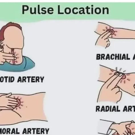 Brachial Artery, Abdominal Aorta, Nurse Problems, Carotid Artery, Cute Black Wallpaper, Medical College, Med School, Medical Information, Medical Students