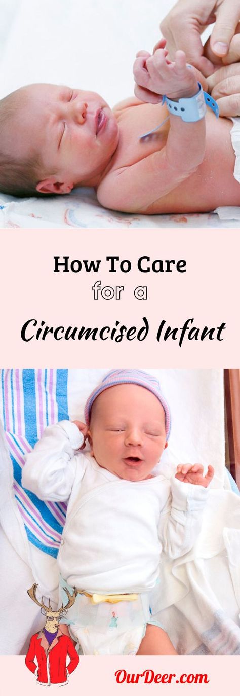 Circumcision Care Newborn, Re Born, Infant Classroom, Newborn Baby Tips, Newborn Mom, Baby Life Hacks, Baby Education, Baby Care Tips, Baby Prep