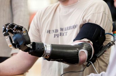 prosthetic limbs image | With a Modular Prosthetic Limb, nerves that previously went to a ... Robotic Prosthetics, Interior Design Gifts, Mechanical Arm, Sense Of Touch, Stylish Interior Design, The Future Is Now, Johns Hopkins University, Latest Design Trends, Action Plan