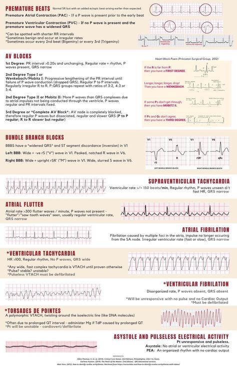 Cardiac Monitor Tech, Cath Lab Technician, Paramedic Cardiology, Cath Lab Nursing, Nursing School Studying Cheat Sheets, Ekg Interpretation, Nurse Teaching, Medical Assistant Student, Paramedic School