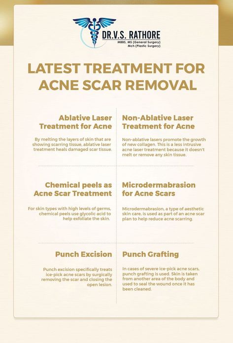 Laser Acne Scar Removal, Treatments For Acne, Acne Laser, Skincare For Oily Skin, Acne Scar, Acne Scar Removal, Skin Tissue, Scar Removal, Scar Tissue