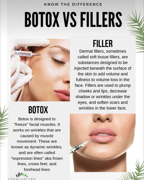 Botox Vs Fillers, Facial Muscles, Dermal Fillers, Beneath The Surface, Wrinkles, Facial, Lips, Make Up, Skin