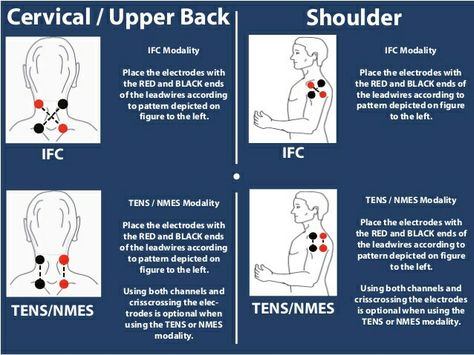 TENS, IFC Tens Unit Placement Charts, Tens Placement, Tens Unit Placement, Pt Exercises, Magic Tattoo Ideas, Tens Machine, Tens Unit, Physical Therapy Exercises, Ten Unit