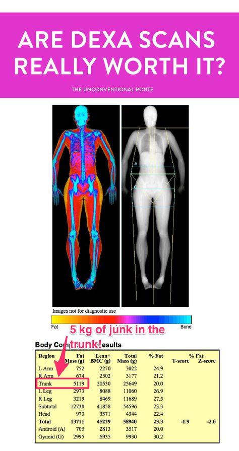 What a DEXA scan is and how its body composition measurements can help you lose fat weight, gain muscle, and strengthen your bones. The Unconventional Route Blog | #dexascan #dexa #bodycomposition #loseweight #bodyscan #bonescan Dexa Scan Results, Bodybuilding Women Diet, Body Scan, Muscle Building Foods, Competition Prep, Diagnostic Imaging, Workout Routine For Men, Muscle Building Workouts, Body Scanning