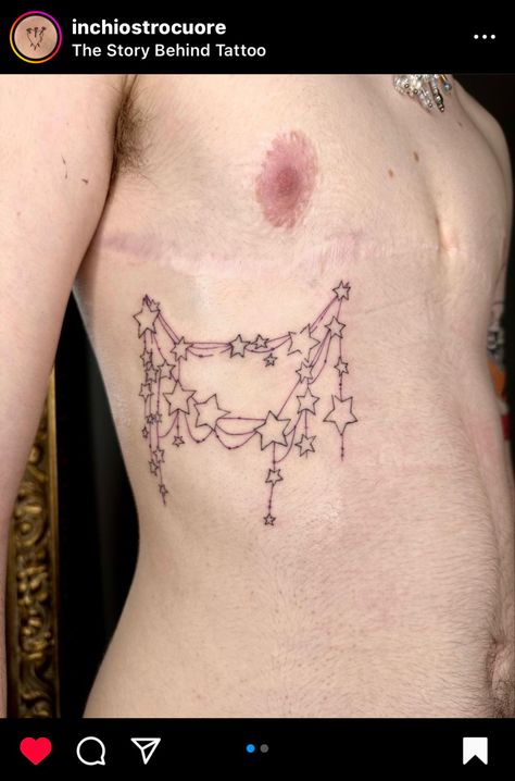 Ftm Surgery Tattoo, Top Surgery Scar Designs, Tattoo Ideas Top Surgery, Trans Masc Chest Tattoos, Chest Surgery Tattoo, Trans Top Surgery Art, Tattoos Top Surgery, Transmasc Tattoo Ideas, Too Surgery Tattoo