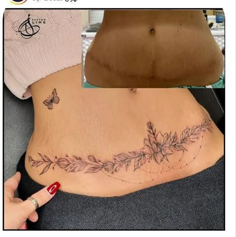 Tattoo Ideas Female Abdomen, Belly Scar Tattoo, C Section Scar Tattoo Cover Up, Lower Stomach Tattoos For Women Cover Up, Surgery Scar Tattoo, Tummy Tucks Tattoo Cover Up, C Section Scar Tattoo, C Section Tattoo, Linda Tattoo