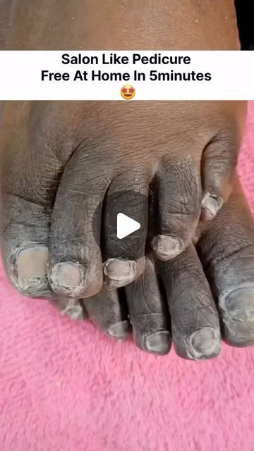 Quick Eye Makeup Tutorial, Bridal Pedicure, Quick Eye Makeup, Acrylic Nail Designs Classy, Feet Nail Design, Lace Blouse Design, Foot Pedicure, Body Massage Techniques, Dark Armpits