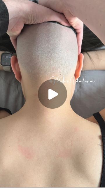 Bald Undercut Women, Head Shave Women, Undercut Styles For Women, Shaved Nape Undercut, Female Shaved Head, Shaved Pixie Cut Edgy, Shaving Head Bald, Shaved Curly Hair, Shaved Head Styles