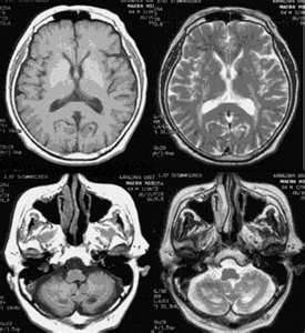 Brain Scan Aesthetic, Brains Aesthetic, Herman Carter, Brain Aesthetic, Myotonic Dystrophy, Brain Scans, Amelia Shepherd, Brain Scan, Mri Scan