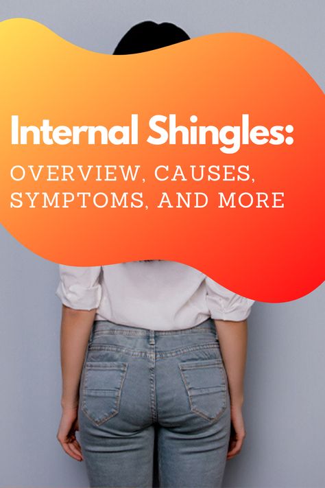 What is internal shingles? Shingles is a common, painful infection that typically causes blisters and rashes on the skin. However, shingles can become more than a skin problem when it affects other systems of the body. These complications of the disease are sometimes referred to as “internal shingles” or systemic shingles. keep reading for more details. Shingles Symptoms Signs, Are Shingles Contagious, What Causes Shingles, Shingles Pain Relief, Shingles Symptoms, Treating Shingles, Shingles Relief, Shingles Rash, Virus Symptoms