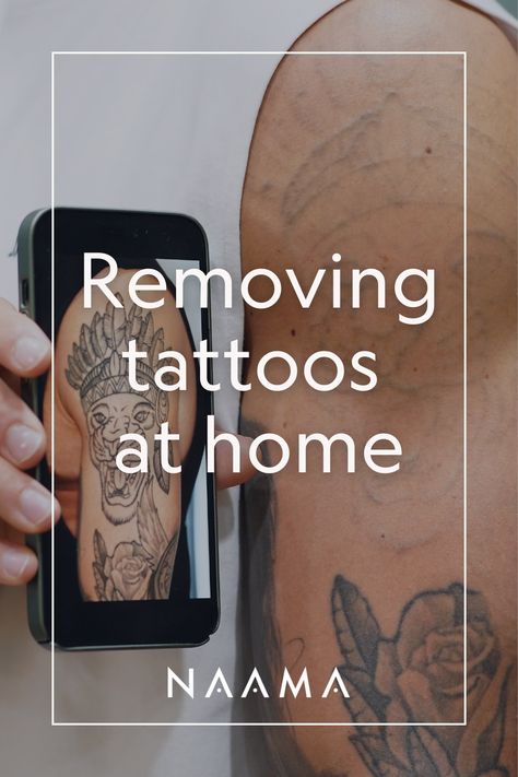 How To Remove A Tattoo At Home, Diy Tattoo Removal, Tattoo Removal Before And After, At Home Tattoo Removal, Tattoo Removal Cream, Homemade Tattoos, Tattoo Off, Eyeliner Tattoo, Laser Tattoo Removal