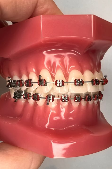 Are you ready to make a bold statement with your braces? Choosing red braces bands is one way to do it! Discover 21 amazing red braces combinations that will turn heads and showcase your unique style. Say goodbye to boring and embrace a vibrant braces journey – you deserve it! Learn more inside the article. Red Braces Color, Maroon Braces, Dark Red Braces, Burgundy Braces, Perfect Teeth Braces, Red Braces, Braces Colors Combinations, Dental Braces Colors, Braces Food