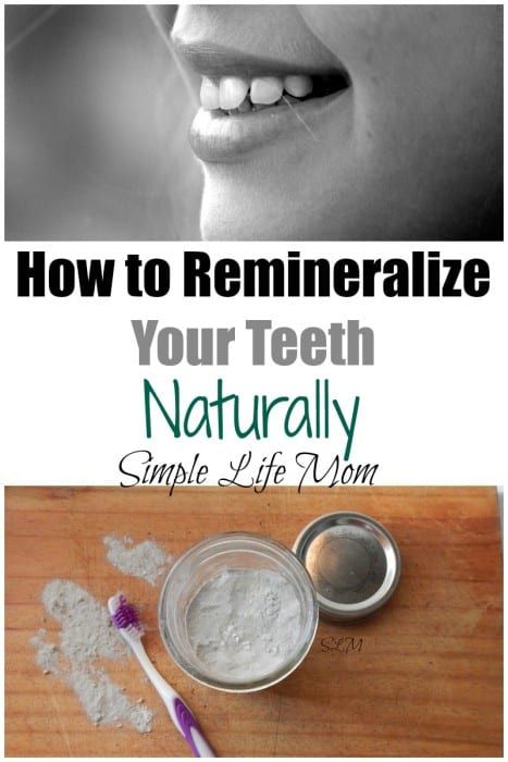 How to Remineralize Teeth Naturally | Simple Life Mom Remineralize Teeth, Remineralizing Toothpaste, Autogenic Training, Natural Mouthwash, Homemade Toothpaste, Heal Cavities, Strengthen Teeth, Teeth Whitening Remedies, Teeth Whitening Diy