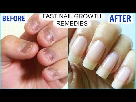 Naturally Grow Your Nails Faster Within A Week | Easy & Effective Home Remedy - YouTube Nail Growth Remedies, Make Nails Grow, Nail Growth Faster, Grow Long Nails, Nail Growth Tips, Grow Nails Faster, Fast Nail, Nail Soak, Nail Care Tips